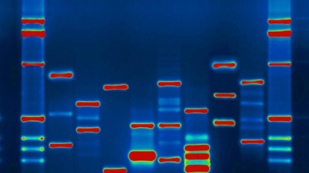 dna